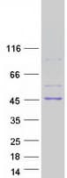 Human ADH1C Protein (Recombinant Myc-DDK (Flag))