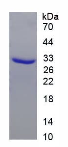 Human CPB2 / TAFI Protein (Recombinant His)