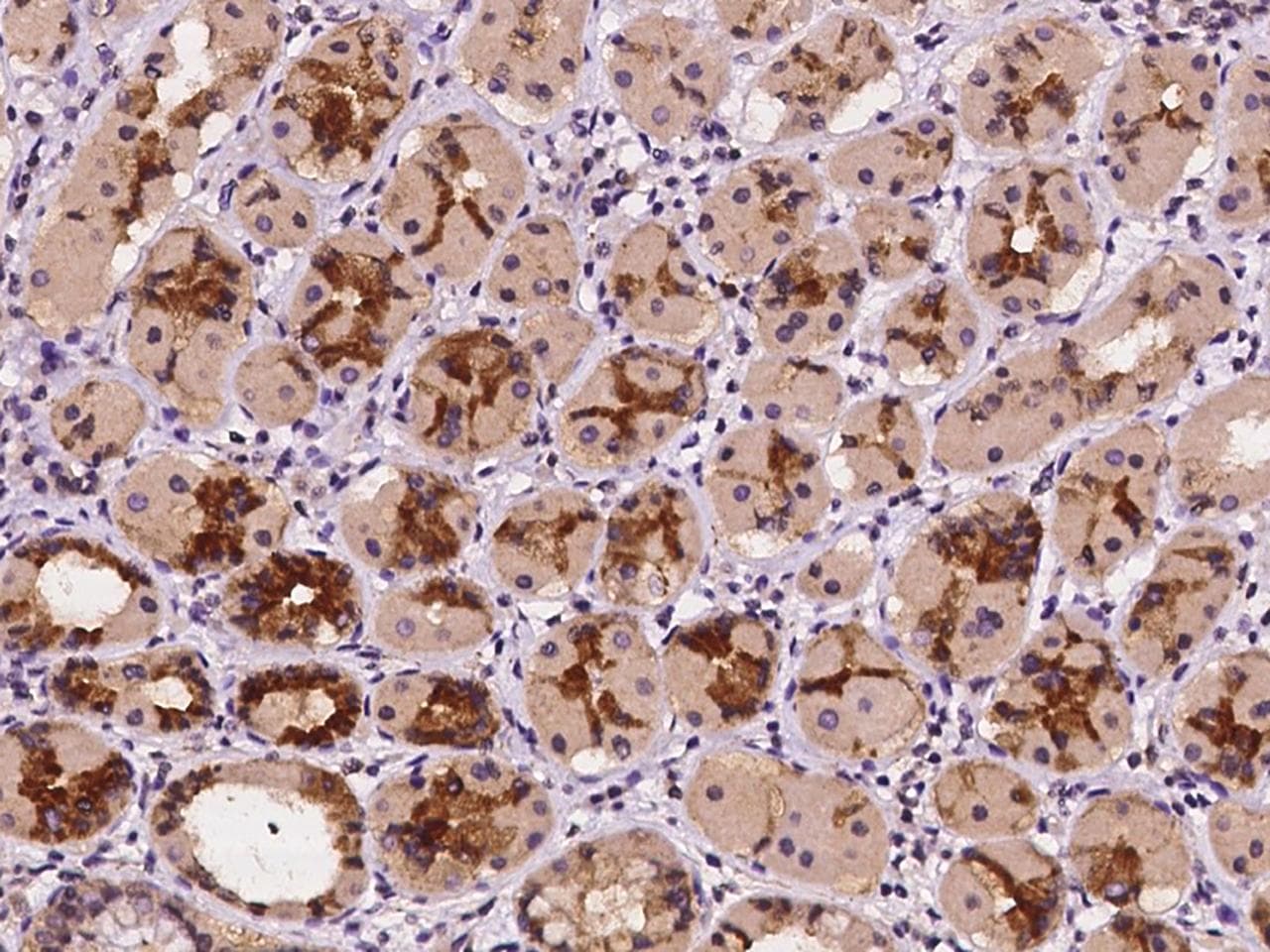 CYB561 Antibody