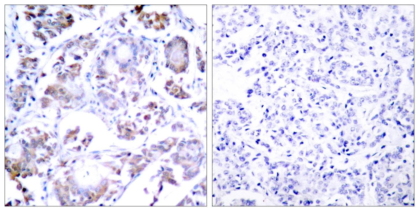 RELA / NFKB p65 Antibody (p254)