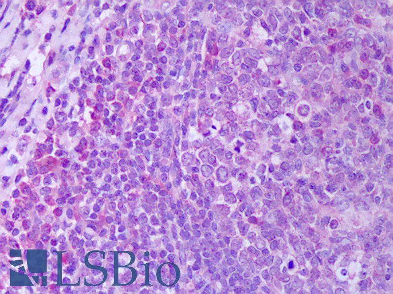 IHC-plus™ TNFSF11 / RANKL / TRANCE Antibody