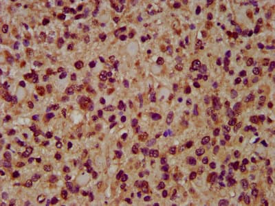 AIMP1 / EMAP II Antibody