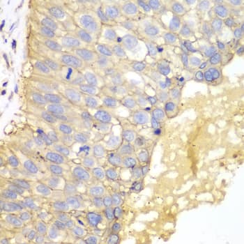 EPCAM Antibody