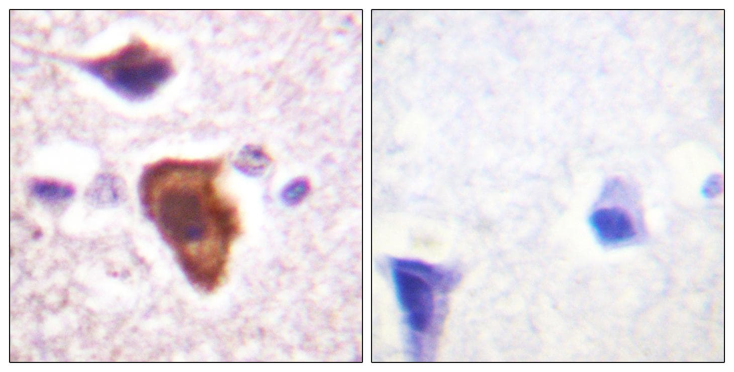 Polyclonal Rabbit anti-Human C5AR1 / CD88 / C5a Receptor Antibody (p338, IHC, IF, WB)