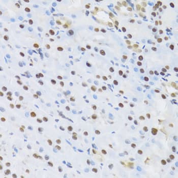 SFN / Stratifin / 14-3-3 Sigma Antibody