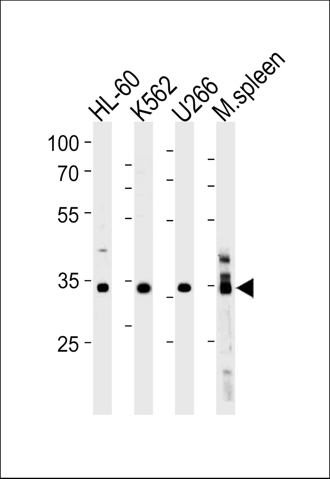 GFI1B Antibody (aa302-330)