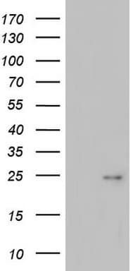 ITGB1BP1 / ICAP1 Antibody (clone OTI7A7)