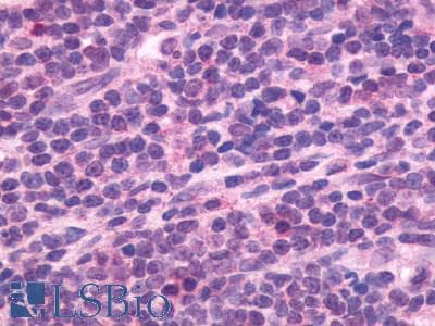 IHC-plus™ Polyclonal Rabbit anti-Human CXCR5 Antibody (C-Terminus, IHC)