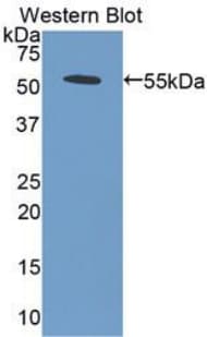 BMP5 Antibody (aa317-454, FITC)