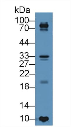 TIMP4 Antibody (aa10-170)