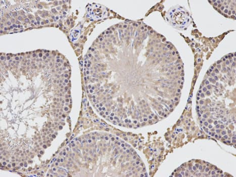 TGFBI Antibody