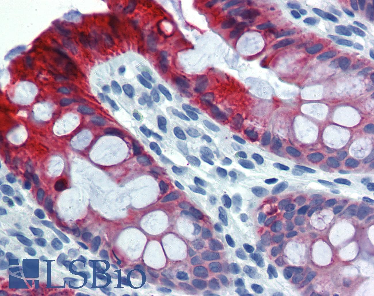 PathPlus™ KRT18 / CK18 / Cytokeratin 18 Antibody (clone C-04)