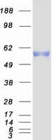 Human PKMYT1 Protein (Recombinant Myc-DDK (Flag))