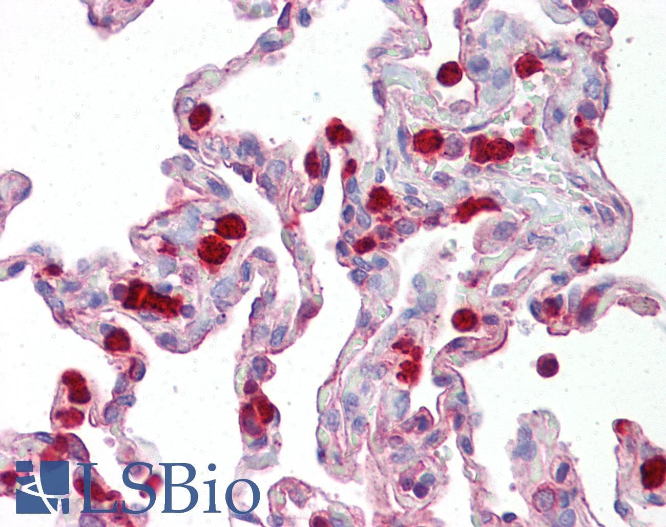 IHC-plus™ ANOS1 / Anosmin Antibody