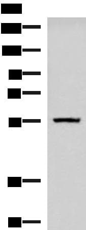 Polyclonal Rabbit anti-Human CAMKK1 Antibody (IHC, WB)