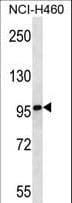 Polyclonal Rabbit anti-Human MMRN2 / Emilin 3 / EndoGlyx-1 Antibody (aa768-797, IHC, WB)