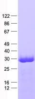 Human SDHB Protein (Recombinant His, N-Terminal)