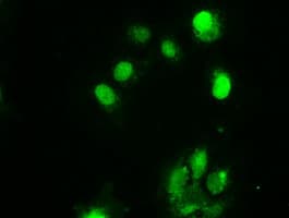 CHEK2 / CHK2 Antibody (clone OTI5C4)