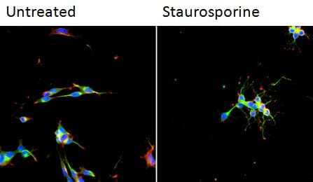 TUBB3 / Tubulin Beta 3 Antibody (Amino Acid: 441-448, clone TU-20)