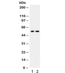 Polyclonal Rabbit anti-Human TRAF2 Antibody (IHC, WB)