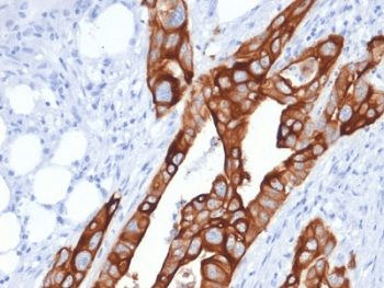 KRT20 / CK20 / Cytokeratin 20 Antibody (clone KRT20/1991, Ready-to-Use)
