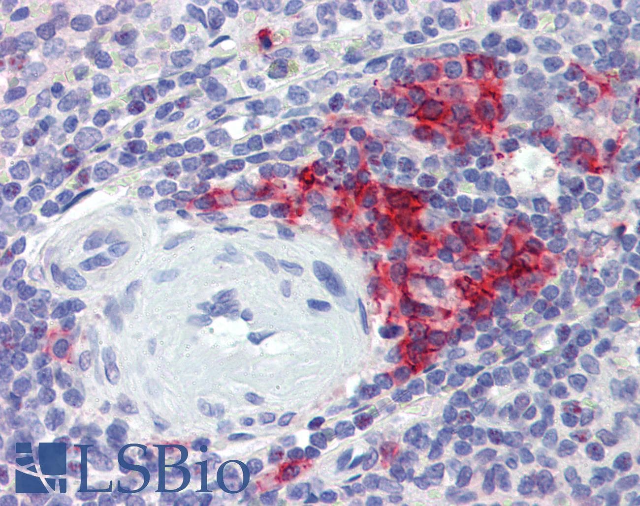 PathPlus™ CD38 Antibody (clone 6E12D4A12)