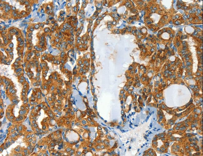 Polyclonal Rabbit anti-Human CLPTM1L / CLPTM1-Like Antibody (IHC)