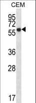 ERO1A / ERO1L Antibody (aa350-379)