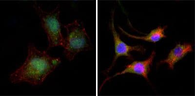 CTNNB1 / Beta Catenin Antibody (clone 4D5)