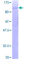 Human Complement C1R Protein (Recombinant GST)