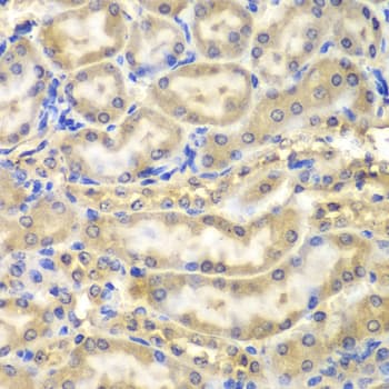Polyclonal Rabbit anti-Human MBP / Myelin Basic Protein Antibody (IHC, IF, WB)