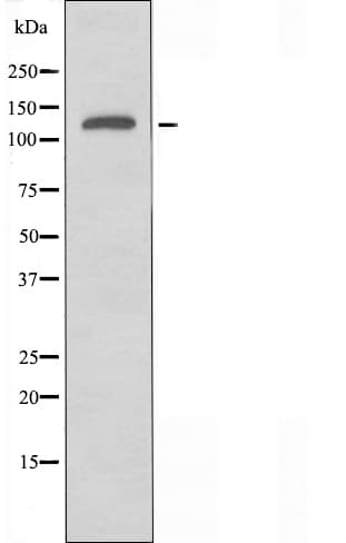 ADGRG6 / GPR126 Antibody