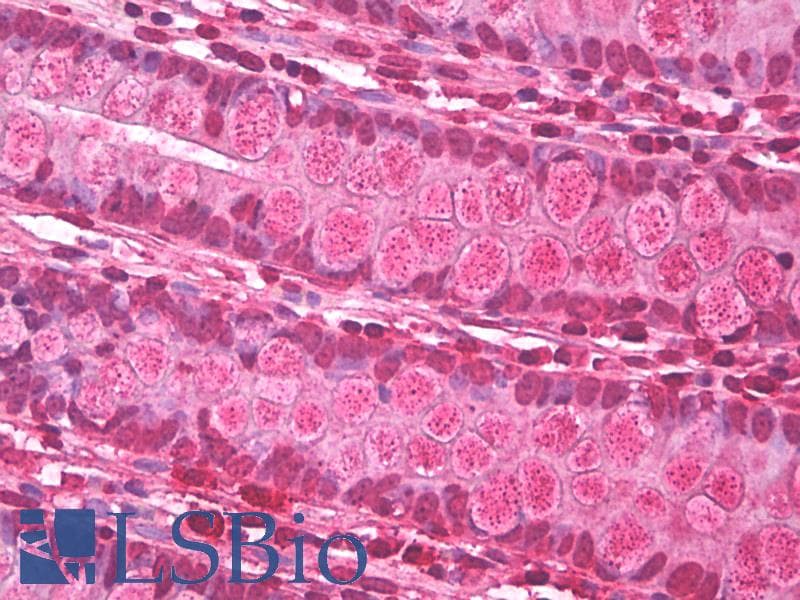 IHC-plus™ p66 / SHC Antibody (SH2 Domain, clone EP332Y)