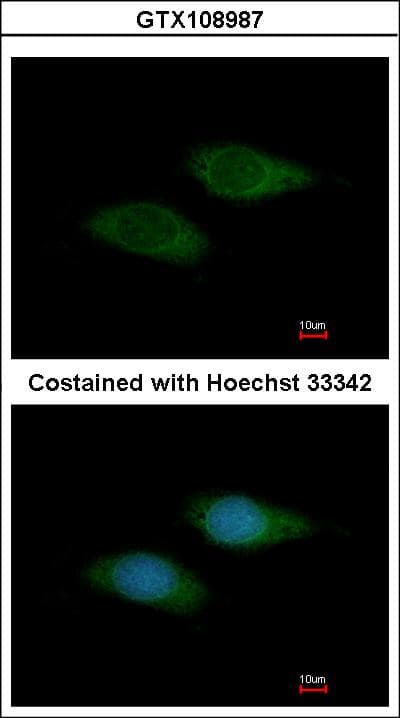 Polyclonal Rabbit anti-Human SNTB2 Antibody (aa174-540, IHC, WB)
