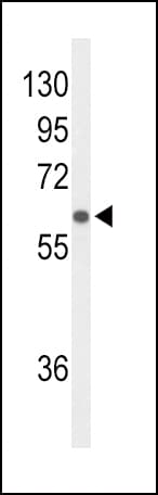 SLCO1B1 / OATP2 Antibody (aa267-293)