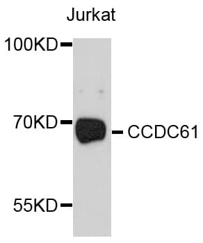 CCDC61 Antibody