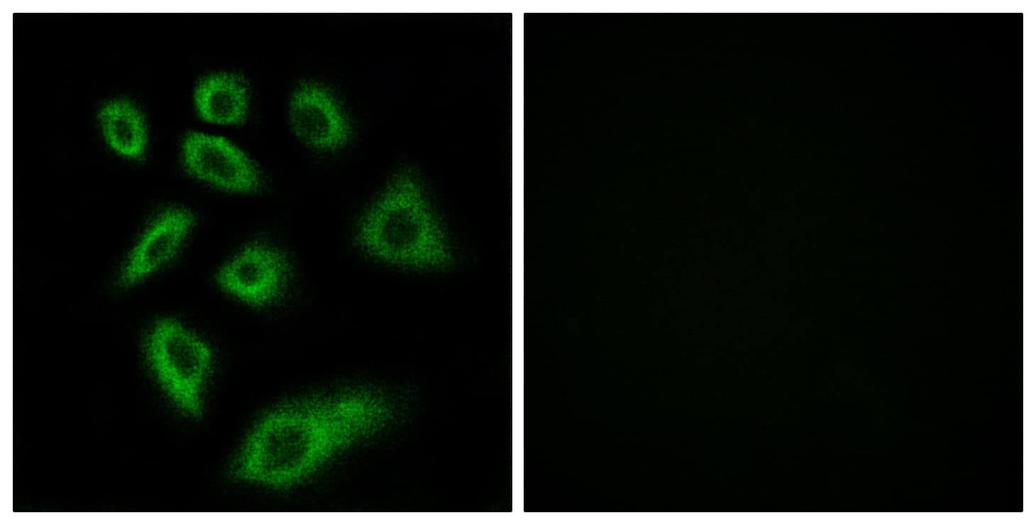 Polyclonal Rabbit anti-Human CYP2W1 Antibody (aa311-360, IHC, IF)