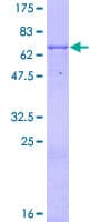 Human WSB1 Protein (Recombinant GST)