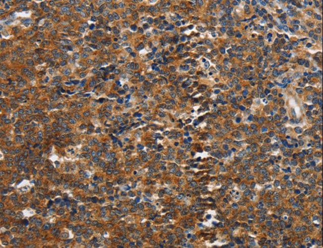 Polyclonal Rabbit anti-Human PIK3R4 Antibody (IHC)