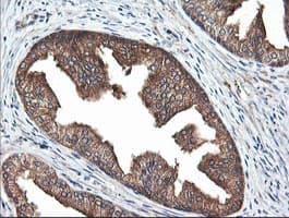 RAB21 Antibody (clone OTI6F11)