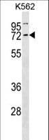 CCNK Antibody (aa27-54)