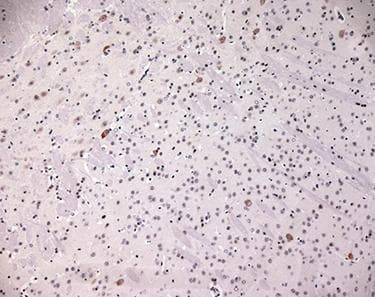 MC4R / Melanocortin 4 Receptor Antibody
