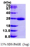 Human RAB1A Protein (Recombinant His)