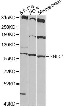 Polyclonal Rabbit anti-Human RNF31 Antibody (WB)