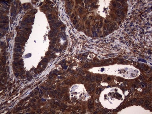 NCR2 / NKP44 Antibody (aa44-190, clone OTI4B8, Carrier-free)