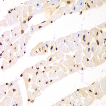 Polyclonal Rabbit anti-Human NONO / P54NRB Antibody (IHC, IF, WB)