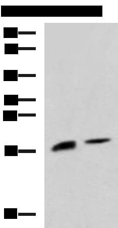 Polyclonal Rabbit anti-Human Ribonuclease A / RNASE1 Antibody (IHC, WB)