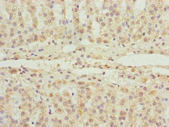 FLAD1 / FADS Antibody (aa1-490)