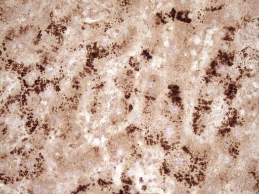 Monoclonal Mouse anti-Human GFI1 Antibody (clone OTI6E8, aa1-180, IHC, WB)