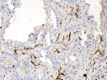 Polyclonal Rabbit anti-Human BCL2L1 / BCL-XL Antibody (IHC, WB)